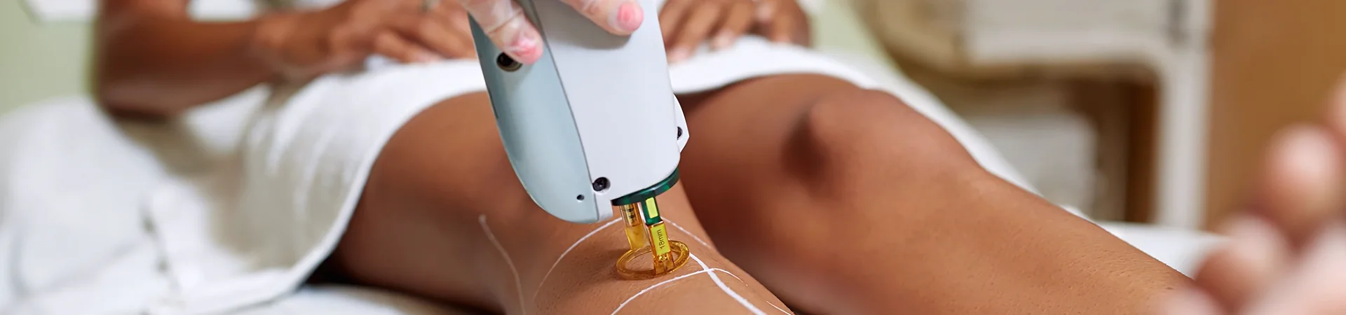 Laser Αποτρίχωση GentleYag Pro U