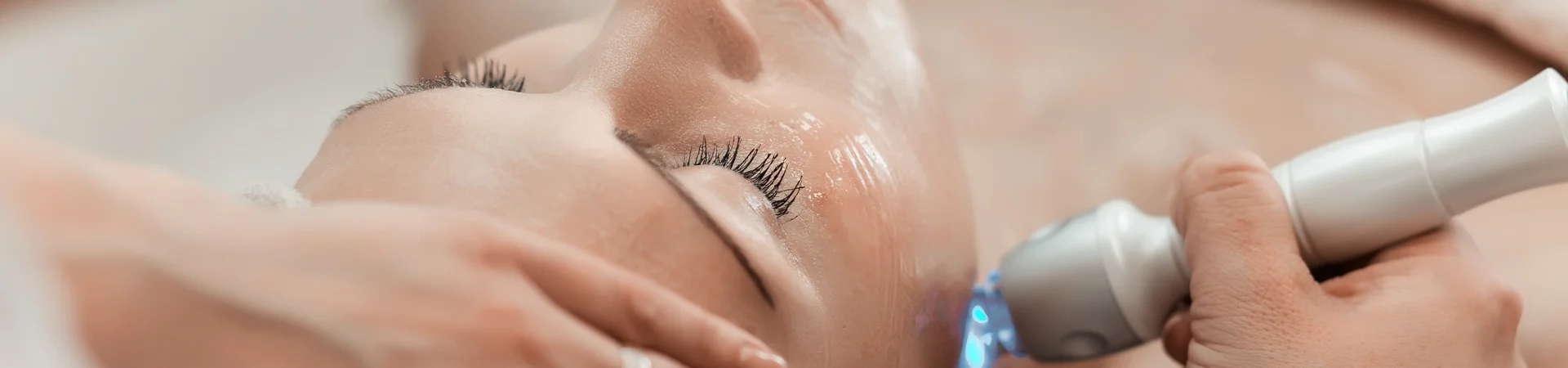 Nd:YAG Laser